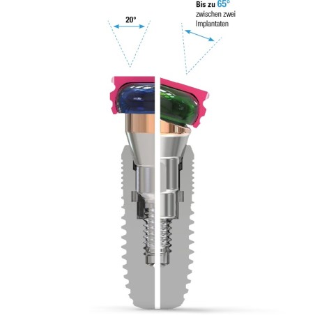 CLICNLOC® 18° I MULTI-BRAND ANGLED ABUTMENTS